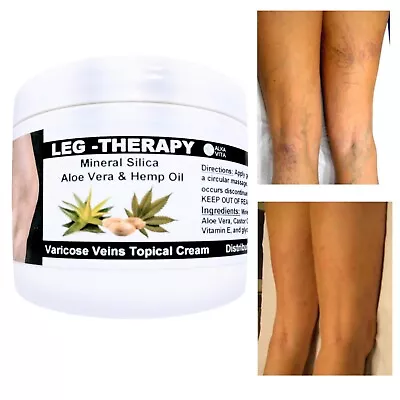 Varicose Vein Leg Muscle Fatigue LEG THERAPY Cream Silica & Hemp Seed ALKAVITA • $17.99