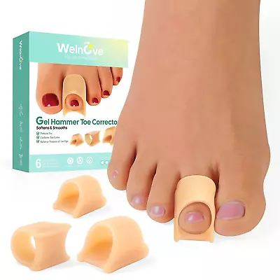 Hammertoe Corrector - 6 Pack Toe Splints - Soft Gel Toe Straighteners - Realign  • $22.30