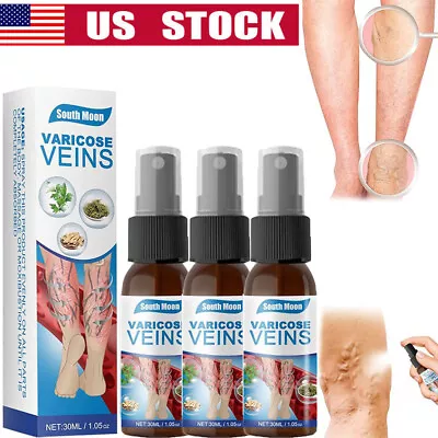 Vein Healing Varicose Veins Treatment SprayVaricose Veins Miracle Spray For Leg • $8.78