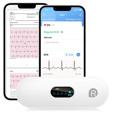 Portable ECG EKG Monitor With Bluetooth Connectivity Heart Rate Monitor Home Use • £62.89