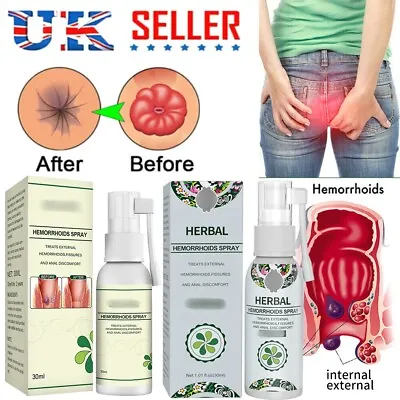£8.56 • Buy Hemorrhoid Treatment Spray 30ml Powerful A+B 100% Natural Herbal Essence