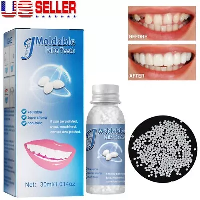 Resin False Teeth Solid Glue Temporary Tooth Repair Moldable Teeth Gap Filler US • $7.54