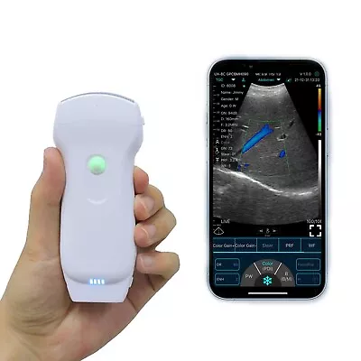 2023 New 3-in-1 Wireless Ultrasound Probe Compatible With IOS Adroid Windows • $1780