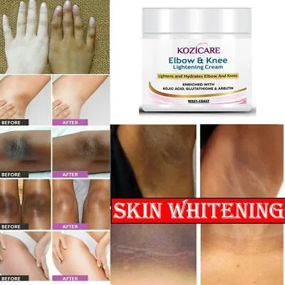 $29.98 • Buy Dark Skin Whitening Cream Armpit Underarm Body Bleaching Lightening Brightening
