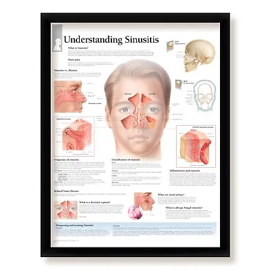 Understanding Sinusitis Medical Poster Diagram Doctors Office School Class 22x28 • $65.99