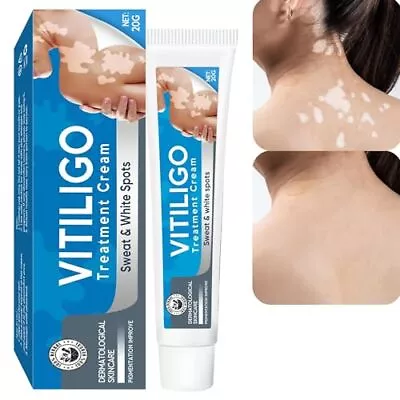 Crema De Vitiligo Tratamiento Natural Reduce Las Manchas Blancas Y Pigmentacion • $36.99