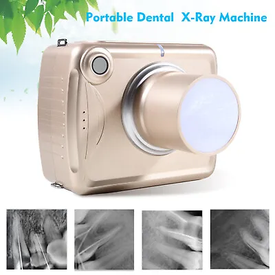 Dental Digital X Ray Unit Portable XRay Machine High Frequency Imaging System Ns • $619