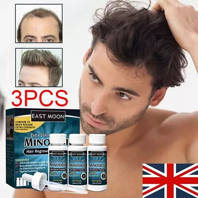 £7.33 • Buy 3 Months Extras Strength Men's Regrowth Treatment Regain Hair Growth Solution
