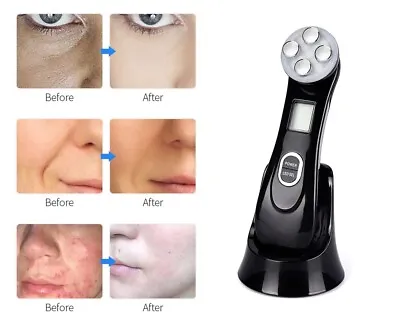 $36.29 • Buy 5 In 1 RF EMS Radio Frequency Ion Wrinkles Removal Anti-Aging Acne Beauty Device
