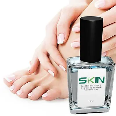 £3.75 • Buy Skinapeel Toe Nail Softener Ingrowing Toenail Treatment Prevention Oil