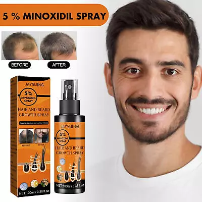 5 % Minoxidil Hair Growth Spray For Men Women 100ml Hair Regrowth Treatment • $11.24