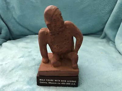 Vintage MAYAN Model Statue Pharmaceutical Medical Condition MALE FIGURE SKIN  • $29.99