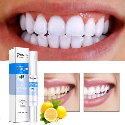 Lápiz Blanqueador De Dientes PurtimiProductos Blanquear Los Diente De Herbaluxy • $7.25