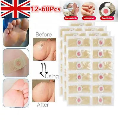 60X Natural Corn Removal Calluses Foot Care Medical Plaster Plantar Warts Toe UK • £3.11