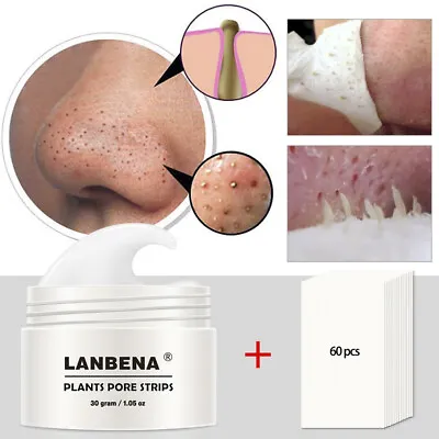 LANBENA 60PCS Pore Strips Blackhead Remover Nose Acne Clean Peel OFF Mud Sticker • $9.93