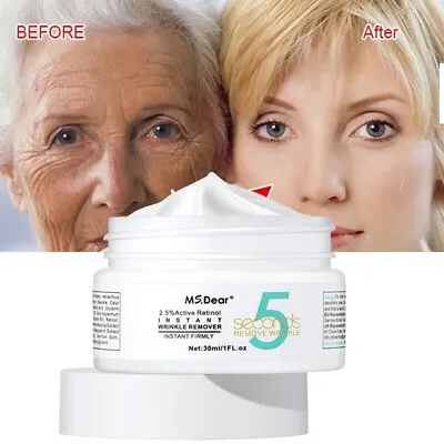 5 Seconds Wrinkle Remove Instant Face Eye Cream Skin Tightening Anti-Aging Serum • £6.95