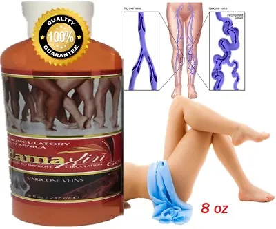 Veg Leg Support Herbal GEL Varicose Veins Vasculitis  Spider Foot Care Cream USA • $11.95