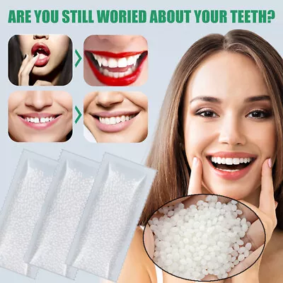 10/20/50/100g Temporary Tooth Repair Kit Thermal Beads Fix Missing Broken Teeth♡ • $4.38