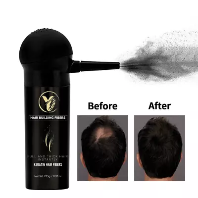 Hair Building Fibres 27.5g+Pump Spray Applicator🔥 UK TRUSTED BRAND YASBRO® • £12.25