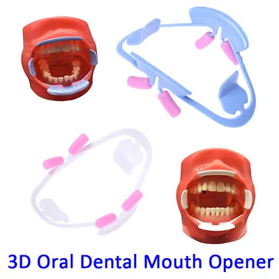 Orthodontic Oral Dental Mouth Opener Intraoral Cheek 3D Lip Retractor Prop UK • £6.49