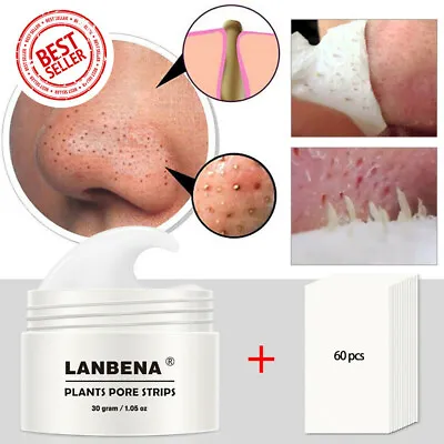 Blackhead Remover Mask Nose & Face Cleansing Mask Cream Acne Treatment Mud Mask • £7.35