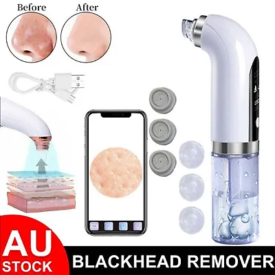 $24.99 • Buy Electric Blackhead Remover Vacuum Pore Face Facial Suction Acne Cleaner Kit