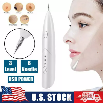 Mini Laser Plasma Pen Freckle Mole Removal Dark Spot Remover Skin Tattoo Beauty • $10.45