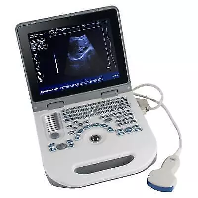 Portable Laptop Ultrasound Scanner + Convex Probe | Full Digital Machine • $1299