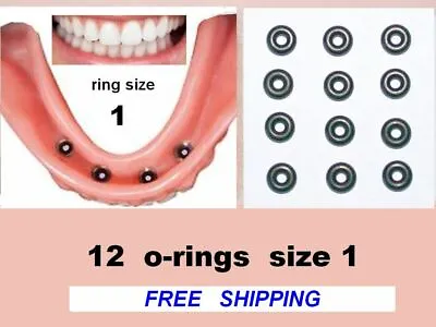 $11.95 • Buy 12 + 2*  Rubber O-RINGS  Size 1  -  For Mini Dental Implants Comp. 0550 A.m.o.