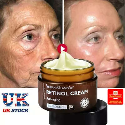 Strong Removal Melasma Whitening Cream Freckle Speckle Sunburn Spots Pigment 30g • £8.95