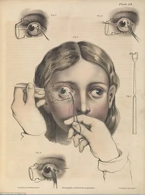 Vintage Eye Anatomy Surgery Medical Chart Fine Art Giclee Canvas Print • $7.99