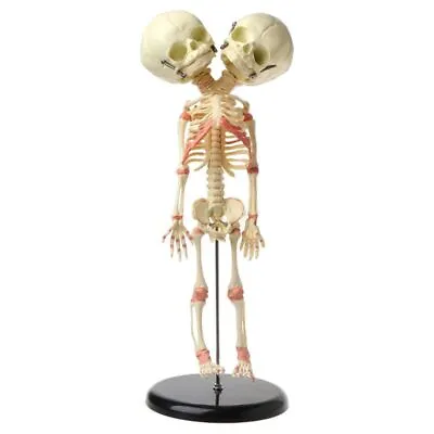 37cm Human Double For Head Baby Skull Skeleton Anatomy Brain Display Study Teach • £33.05