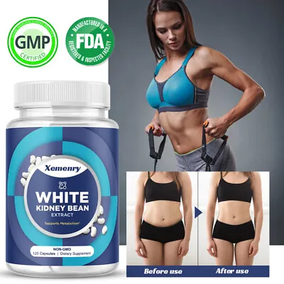 White Kidney Bean Extract 1200mg -Weight LossCarb BlockersAppetite Suppression • £8.51