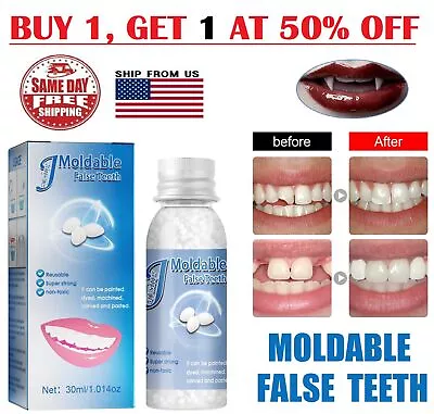 Resin False Teeth Solid Glue Temporary Tooth Gap Filler Tooth Repair Moldable US • $8.36