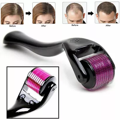 $16.97 • Buy  540 Micro-needling Derma Roller Hair Beard Regrowth Anti Hair Loss Treatment 