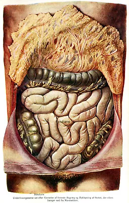 Vtg German Male Abdomen Anatomy Dissection Picture #1 NEW Fine Art Giclee Print  • $6.99