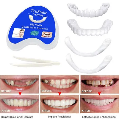 Smile Snap On False Teeth Upper Lower Dental Veneers Dentures Tooth Cover Set • $17.99