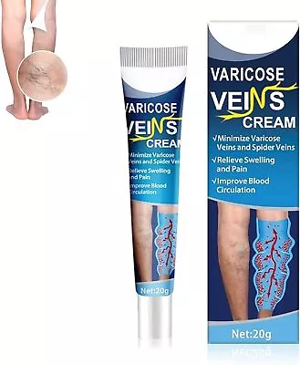 Mucopolysaccharide Polysulfate Cream Varicose Veins Cream Legs Care Cream • £4.19