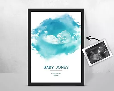 Personalised BABY Scan Ultrasound Watercolour Print/ New Mum/ Mother Gift Idea • £12.35