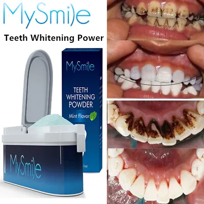 MySmile Teeth Whitening Powder MySmile Kit Remove Tooth Coffee Soda Stains Mint • £19.99