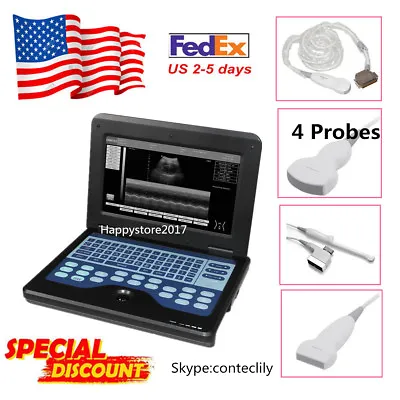 CE 4 Probes Portable Ultrasound Scanner Laptop Machine 10.1 CMS600P2 USBVideo • $2449