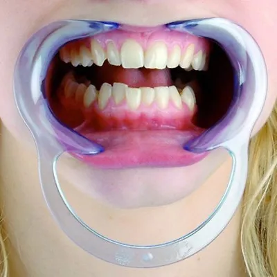 20 Pcs Mouth C Shape Opener Dental Cheek Retractor Fun Game Watch Large Size • £18.61