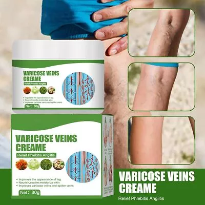 Varicose Vein Cream For Legs Eliminate Varicose Veins And Spider Vein • $6.59