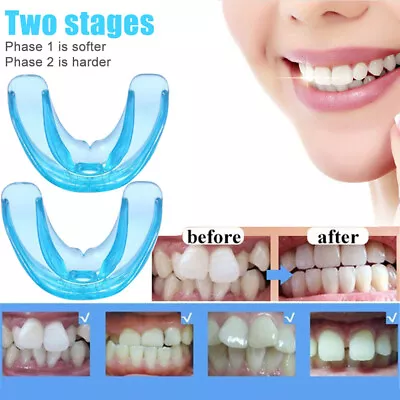 $9.39 • Buy 2Stage Dental Braces Teeth Trainer Alignment Dental Appliance Tooth Orthodontic