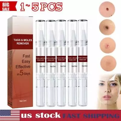 5PCS Wipe Off Skin Tags & Moles Removal Quick Safe Remover Restore Skin US Stock • $15.99