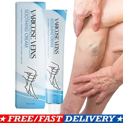 Varicose Veins Cream Varicose Veins Treatment Cream For Legs • $8.88