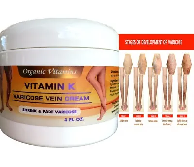 4 Oz - Vitamin K Cream - Thread Spider Varicose Veins Scars Rosacea Capillaries • $13.99