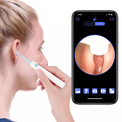 Ear Wax Removal Kit Camera 1920P Smart Bud Cleaner For IPhone Ipad Ios & Android • £16.39