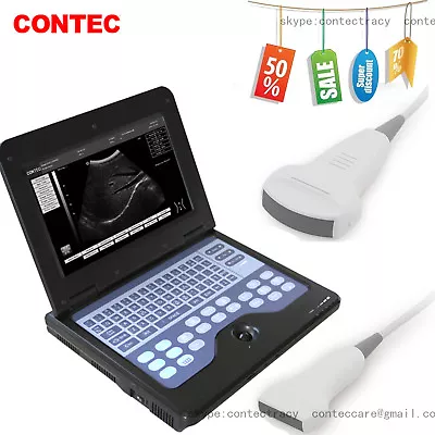 CE Portable Digital Ultrasound Machine Scanner System3.5M Convex 7.5M Linear • £1468