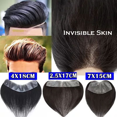 Mens Toupee Human Hair Replacement Top Piece Front Hairline Invisible Thin Skin • £45.77